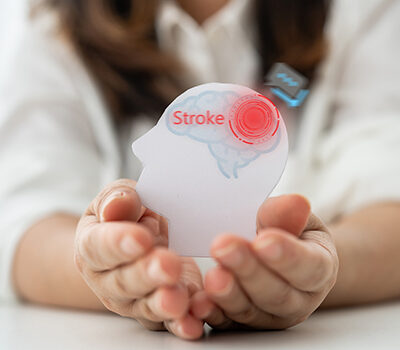 ICD-10 Spotlight Series, Part 7: Beyond “History of Stroke”—Unlocking Accurate Coding of CVA Sequelae